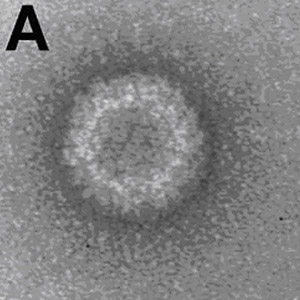 Colo Tick Fever Virus